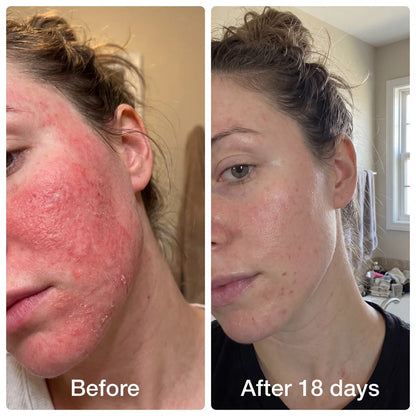 Advanced Salmon PDRN Cellular Repair Serum