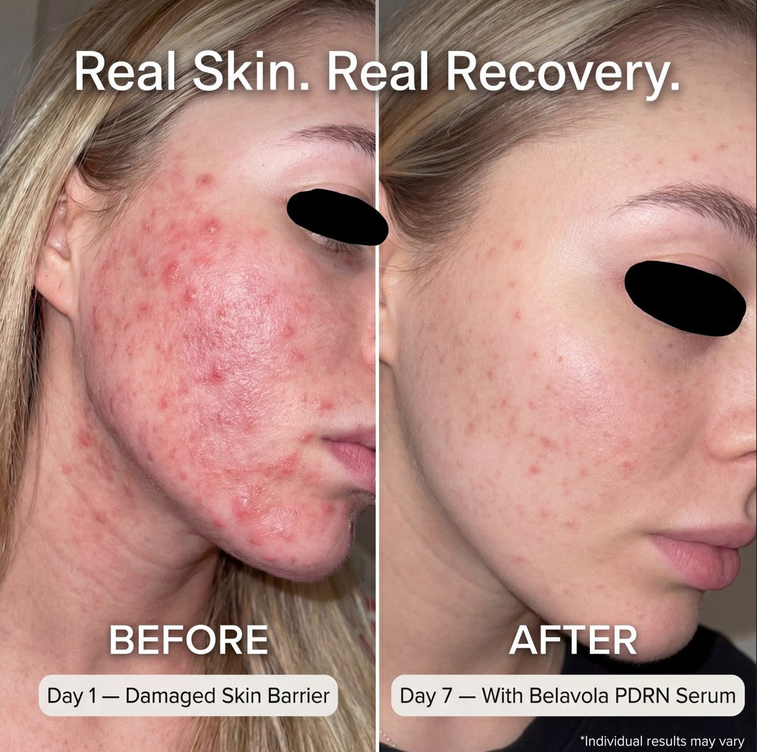 Advanced Salmon PDRN Cellular Repair Serum